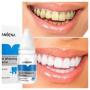 Teeth Whitening Essence Ultimate Cleaner