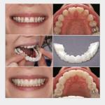 Generic Soft Silicone Denture Teeth Veneers Temporary  Teeth Lower Bottom