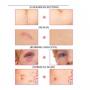 Pei Mei Herbal Scar/burns/cuts/stretchmarks/acne/spots Removal Cream
