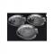 Luminarc Fish Plate Set - 7 Pieces