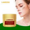 Scar Removal Cream Acne Treatment